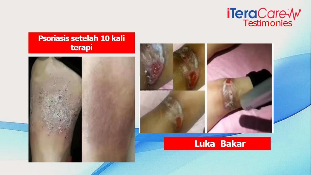 ITERA CARE