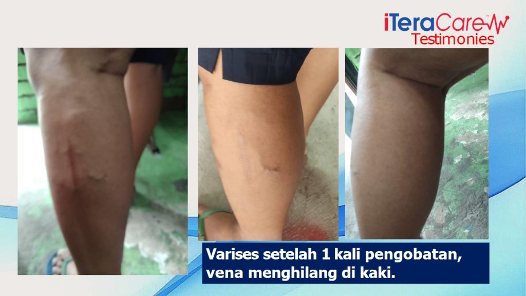 ITERA CARE