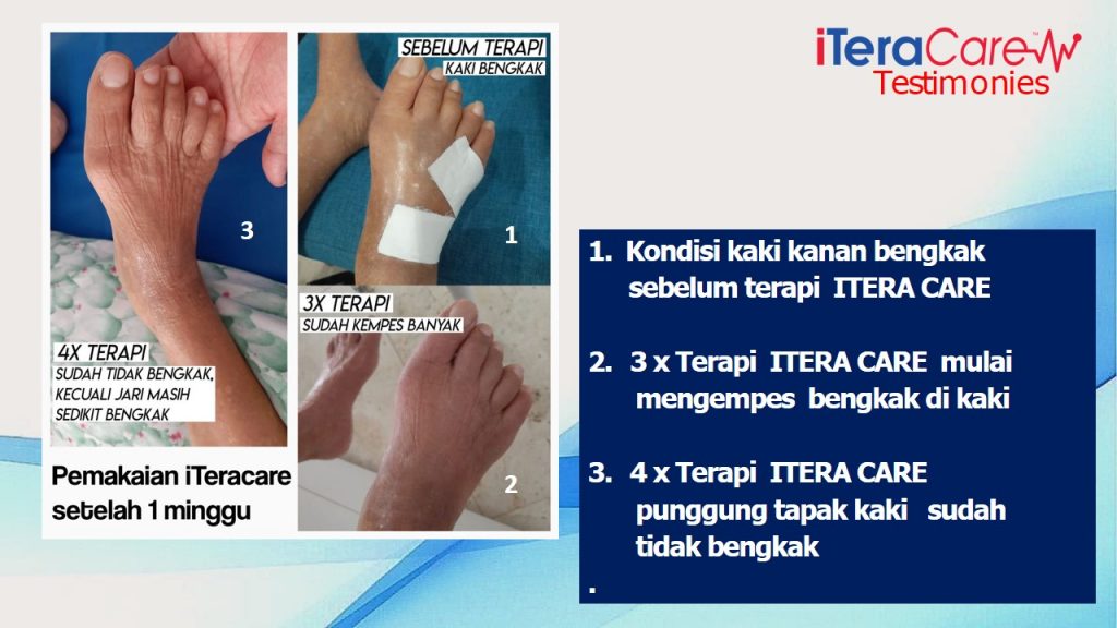 ITERA CARE