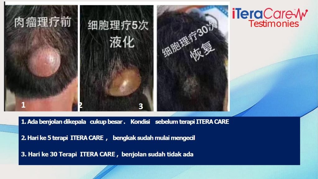 ITERA CARE