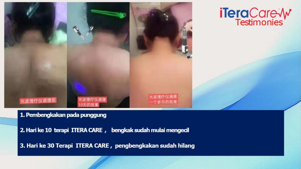 ITERA CARE