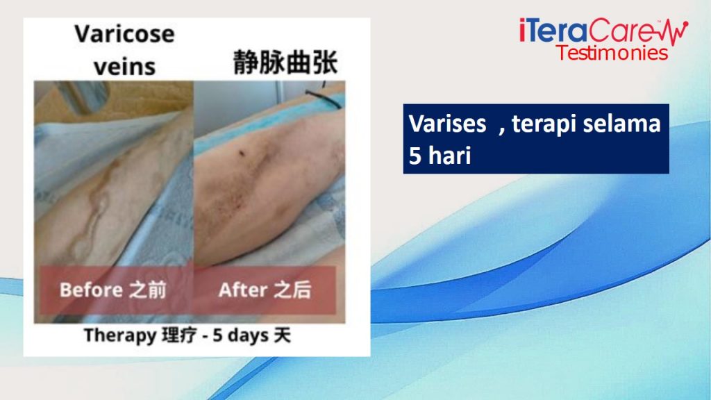 ITERA CARE